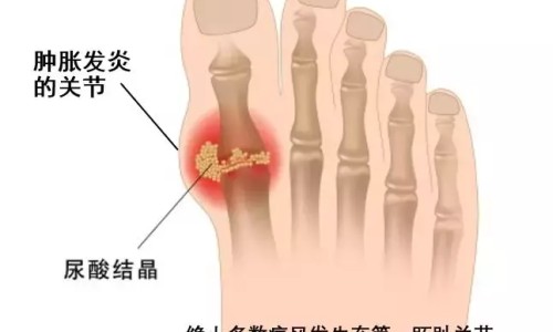 癫痫病人发病时怎样正确施救-癫痫病人会因为天气变化发病么网 - 网站提供癫痫病天气热会发作吗小常识、癫痫病人会因为天气变化发病么为什么